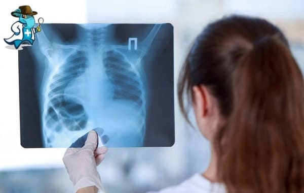 Qué Exclusiones Tendría un Seguro de Salud que Cubra la Radiología en España
