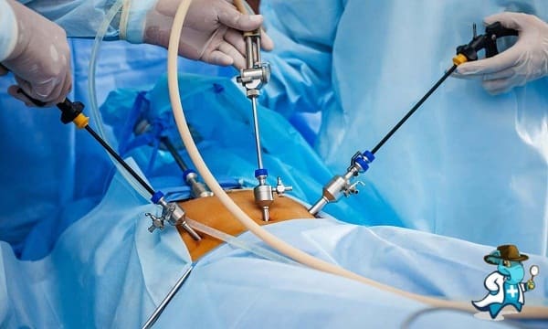 Cuánto Cuesta un Seguro de Salud que Cubra la Laparoscopia en España