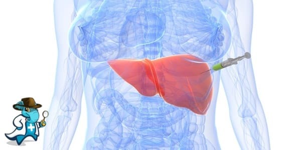 ¿Cubre el Seguro de Salud la Biopsia Hepática en España?