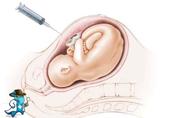 ¿Qué Periodo de Carencia Tiene un Seguro de Salud que Cubra la Biopsia Corial en España?