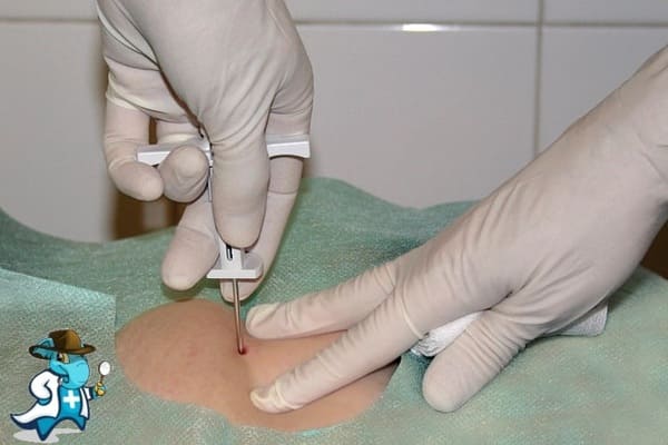 ¿Qué Periodo de Carencia Tiene un Seguro de Salud que Cubra la Biopsia de la Medula Ósea en España?
