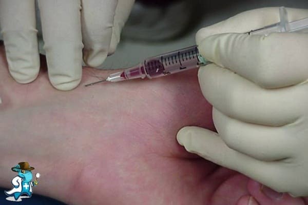 Qué Periodo de Carencia Tiene un Seguro de Salud que Cubra la Gasometría en España