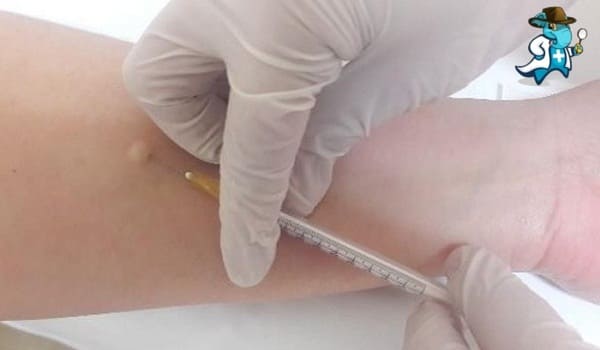 Cuánto Cuesta un Seguro de Salud que Cubra la Mantoux o Prueba de la Tuberculina en España