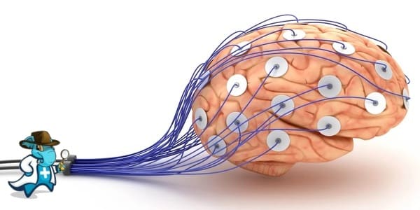 ¿Cubre el Seguro de Salud el Encefalograma en España?