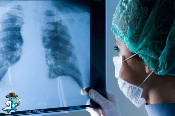 ¿Cubre el Seguro de Salud la prueba de Toracoscopia en España?