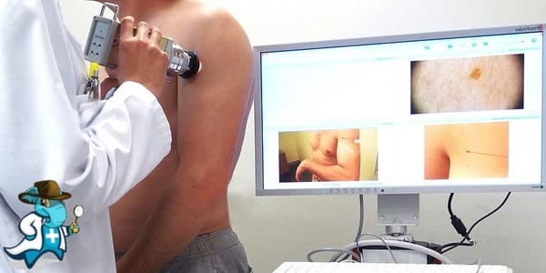¿Qué Periodo de Carencia Tiene un Seguro de Salud que Cubra la Dermatoscopia Digital en España?