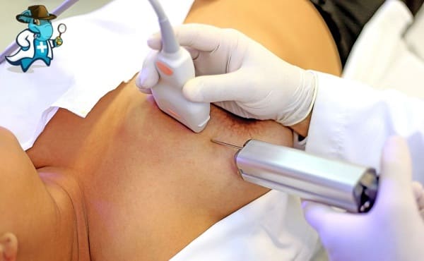 Qué Periodo de Carencia Tiene un Seguro de Salud que Cubra la PAAF o la Punción-Aspiración con Aguja Fina en España