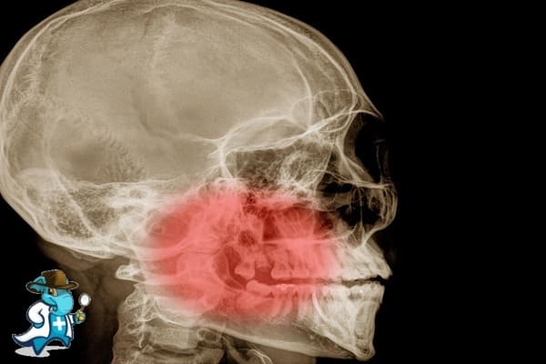 ¿Cuánto Cuesta un Seguro de Salud que Cubra Lesiones Maxilares en España?