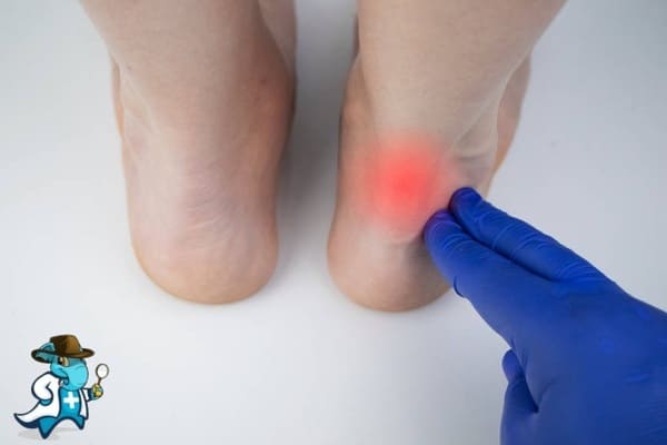 ¿Cuánto Cuesta un Seguro de Salud que Cubra Traumatismos en el Tendón de Aquiles en España?