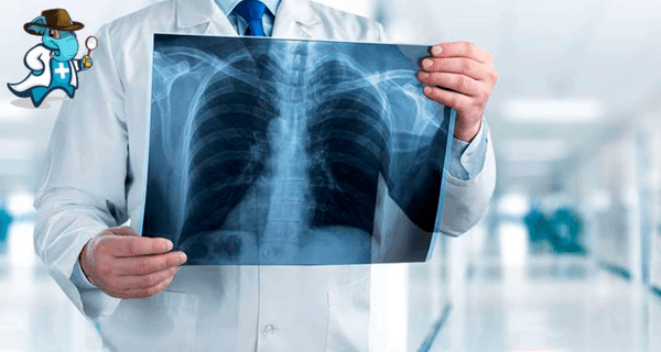 Cuánto Cuesta un Seguro de Salud que Cubra la Radiografía de Tórax en España