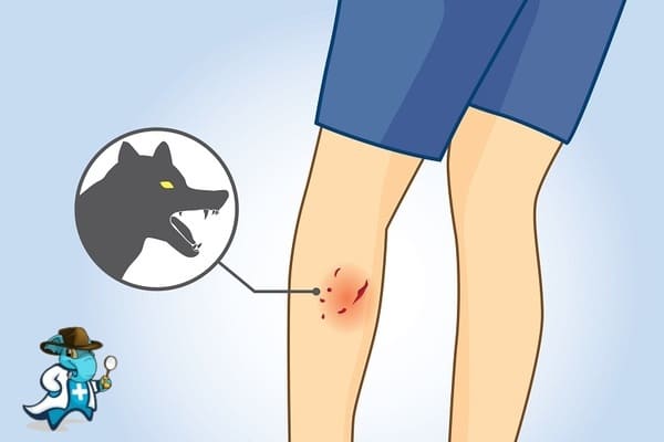 ¿Cuánto Cuesta un Seguro de Salud que Cubra las Mordeduras de Animales en España?