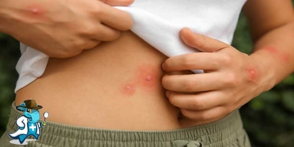 ¿Cuánto Cuesta un Seguro de Salud que Cubra las Picaduras de Insectos en España?