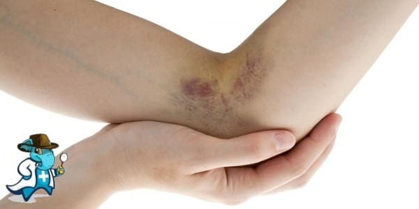 ¿Cuánto Cuesta un Seguro de Salud que Cubra una Contusión en España?