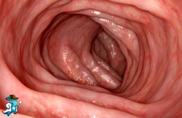 ¿Cubre el Seguro de Salud la Sigmoidoscopia en España?