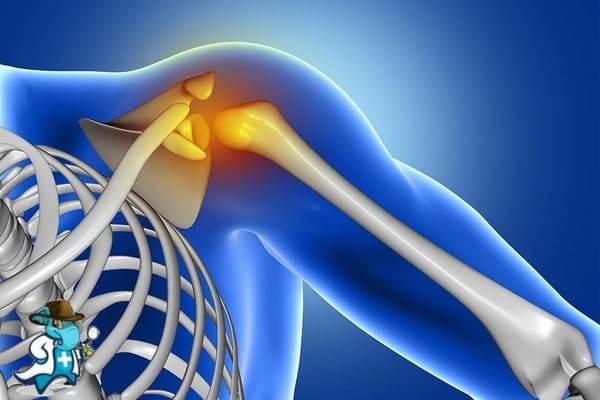 ¿Me Cubre el Seguro de Salud en Caso de Lesiones del Manguito Rotatorio del Hombro en España?