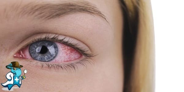 ¿Me Cubre el Seguro de Salud en Caso de una Hemorragia o Derrame Ocular en España?