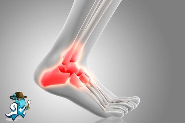 ¿Qué Periodo de Carencia Tiene un Seguro de Salud que Cubra Fracturas o Huesos Rotos en España?