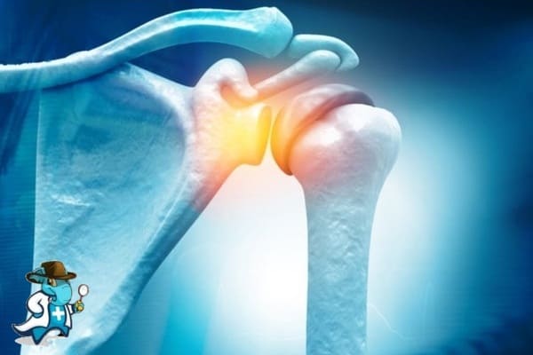 ¿Qué Periodo de Carencia Tiene un Seguro de Salud que Cubra Lesiones del Manguito Rotatorio del Hombro en España?