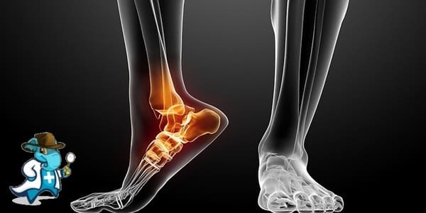 ¿Qué Periodo de Carencia Tiene un Seguro de Salud que Cubra Torceduras o Distensiones en España?