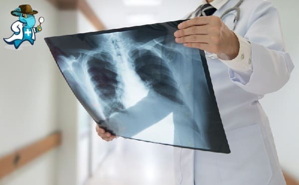 Qué Periodo de Carencia Tiene un Seguro de Salud que Cubra la Radiografía de Tórax en España