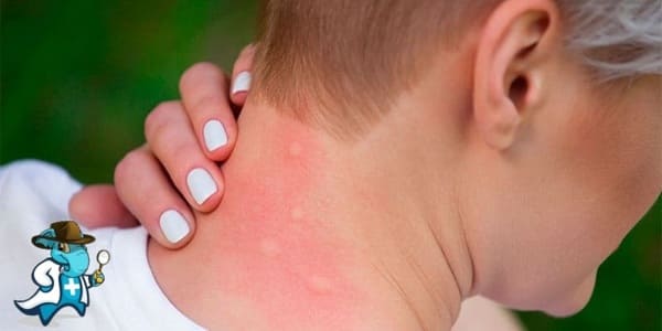 ¿Qué Periodo de Carencia Tiene un Seguro de Salud que Cubra las Picaduras de Insectos en España?