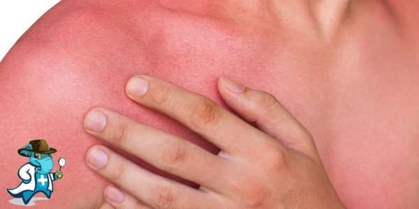 ¿Qué Periodo de Carencia Tiene un Seguro de Salud que Cubra las Quemaduras en España?