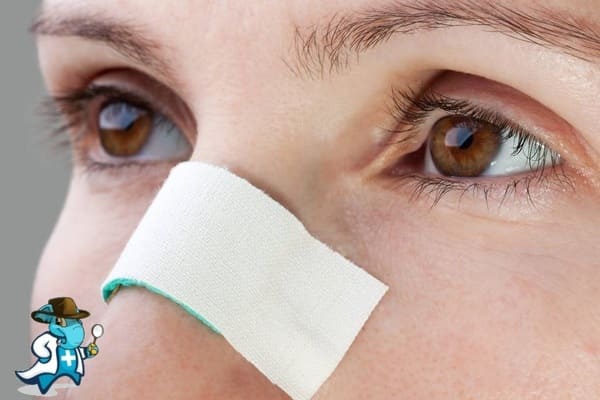 ¿Me Cubre el Seguro de Salud en Caso de una Fractura Nasal en España?