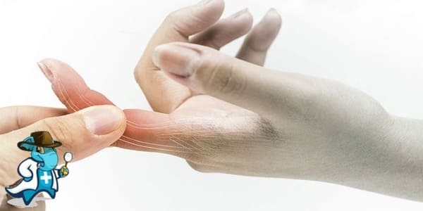 ¿Me Cubre el Seguro de Salud en Caso de una Fractura de Dedo en España?