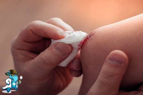 ¿Qué Periodo de Carencia Tiene un Seguro de Salud que Cubra Raspaduras, Arañazos y Laceraciones en España?