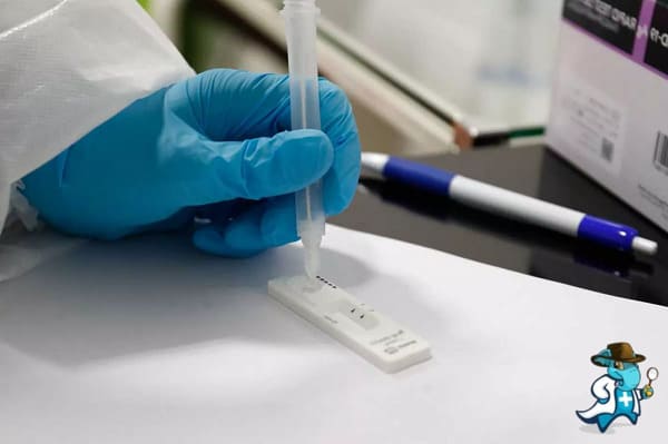 Qué Periodo de Carencia Tiene un Seguro de Salud que Cubra la Prueba o Test de Antígenos en España
