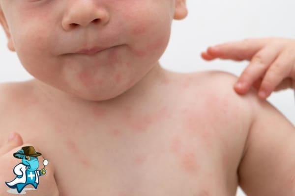 ¿Aumenta el Precio del Seguro de Salud Para un Niño con una Alergia en España?