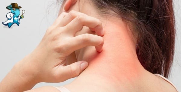 Aumenta el Precio del Seguro de Salud Para una Persona con una Alergia a las Nueces en España
