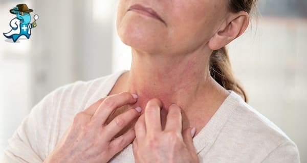 Aumenta el Precio del Seguro de Salud Para una Persona con una Alergia a los Albaricoques en España