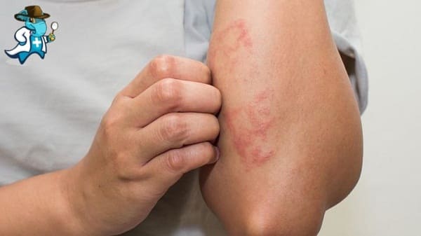 Aumenta el Precio del Seguro de Salud Para una Persona con una Alergia al Centeno en España