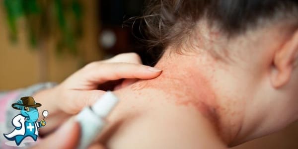 ¿Aumenta el Precio del Seguro de Salud Para una Persona con una Alergia al Níquel en España?
