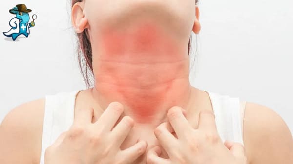 Cubre el Seguro de Salud la Alergia a los Piñones en España
