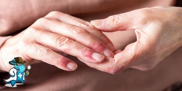 ¿Puedo Ocultar que Tengo Esclerodermia Para Contratar el Seguro de Salud en España?