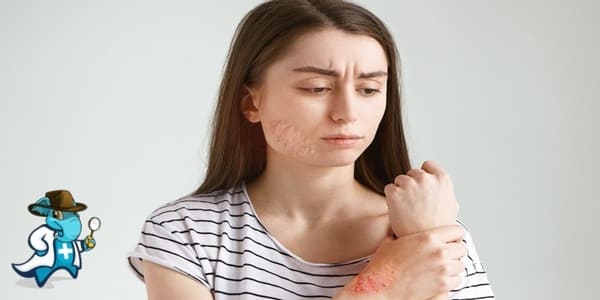 ¿Puedo Ocultar que Tengo Lupus Para Contratar el Seguro de Salud en España?