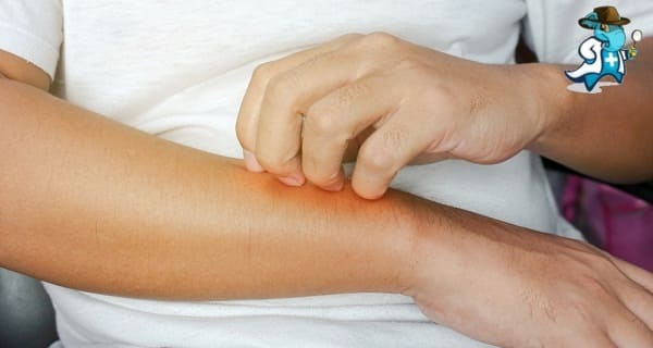 Qué Exclusiones Tendría un Seguro de Salud Para una Persona con una Alergia a la Avena en España