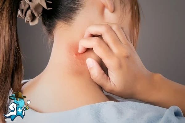 ¿Qué Exclusiones Tendría un Seguro de Salud Para una Persona con una Alergia al Níquel en España?