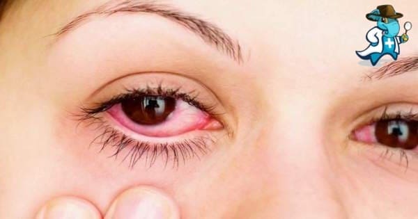 Aumenta el Precio del Seguro de Salud Para una Persona con una Conjuntivitis Alérgica en España
