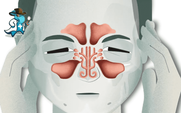 Aumenta el precio del seguro de salud para una persona con una Poliposis nasal en España