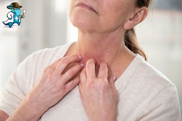 Cubre el Seguro de Salud el Sarpullido en España