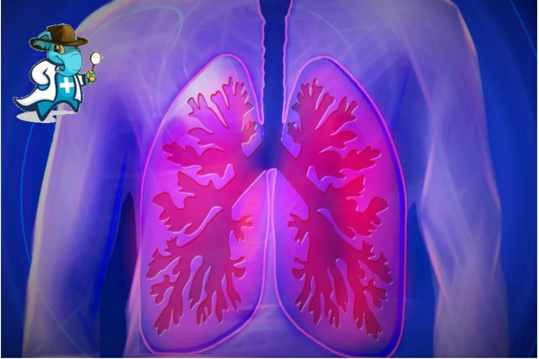¿Qué Exclusiones Tendría un Seguro de Salud Para una Persona con una Aspergilosis Broncopulmonar Alérgica en España?