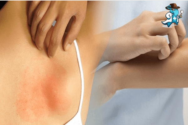 Aumenta el precio del seguro de salud para una persona con una alergia al Detergente de ropa en España