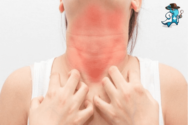 Aumenta el precio del seguro de salud para una persona con una alergia al maní en España